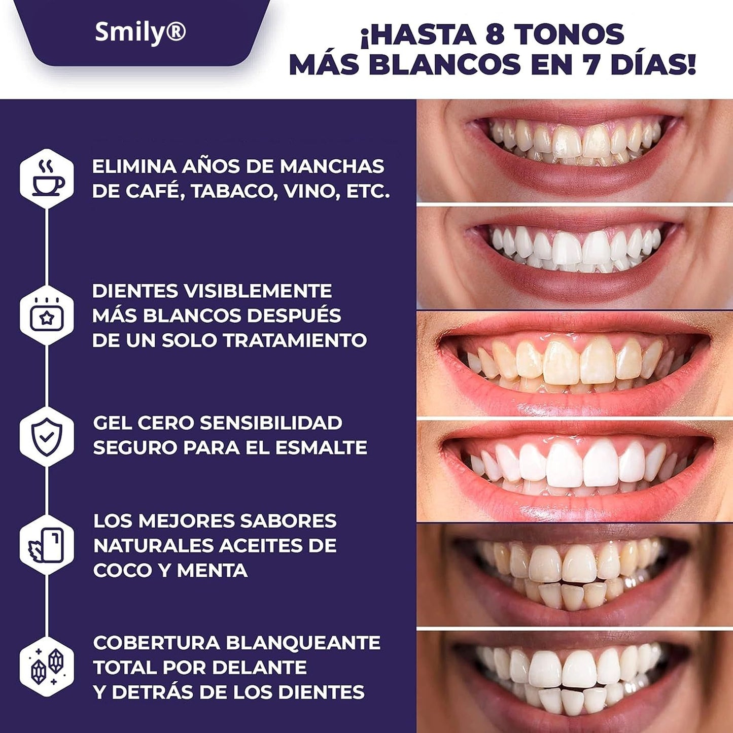 Tiras blanqueadoras Smily®