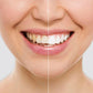 Tiras blanqueadoras Smily®