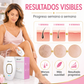 Depiladora láser Skintec®